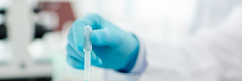 烯基磺酸鈉檢測(cè)